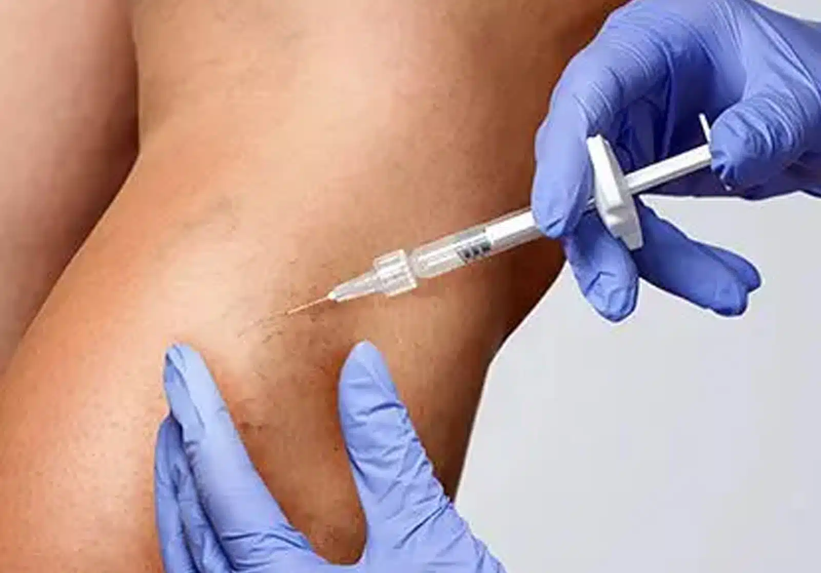 recovery is typically smooth recovery is typically smooth