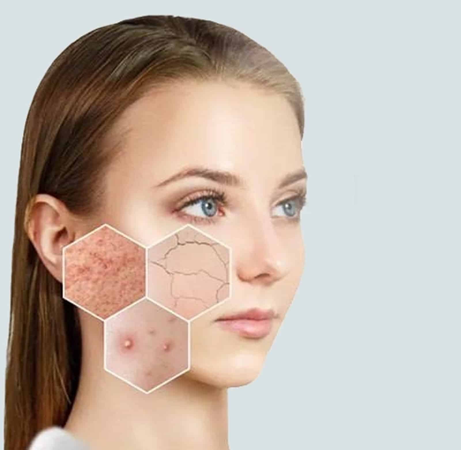 Enhancing Results with Combination Treatments Enhancing Results with Combination Treatments