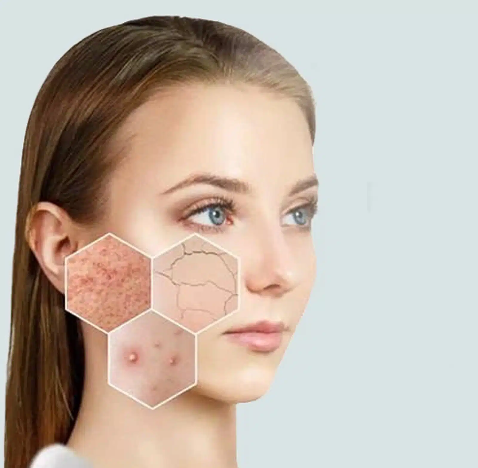 Enhancing Results with Combination Treatments Enhancing Results with Combination Treatments