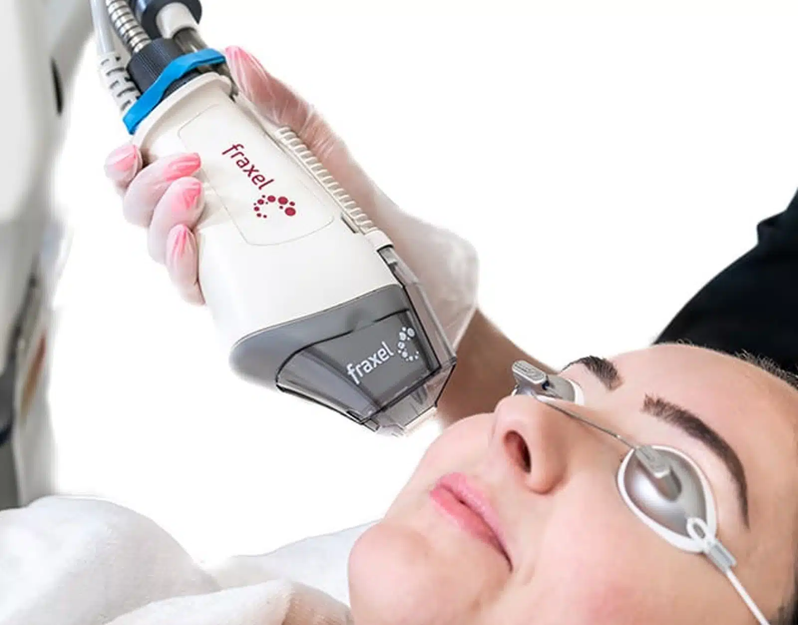 Fraxel Laser Orlando