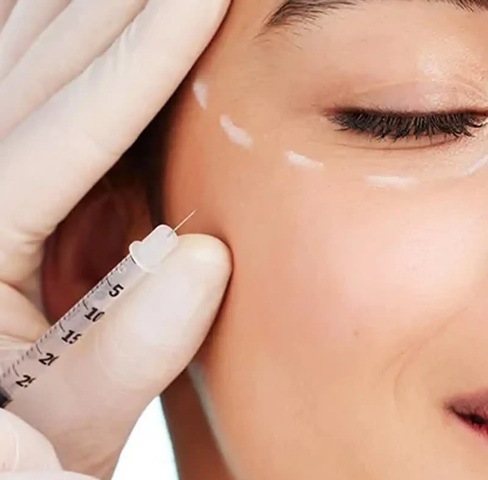 Injectable Fillers in Winter Park