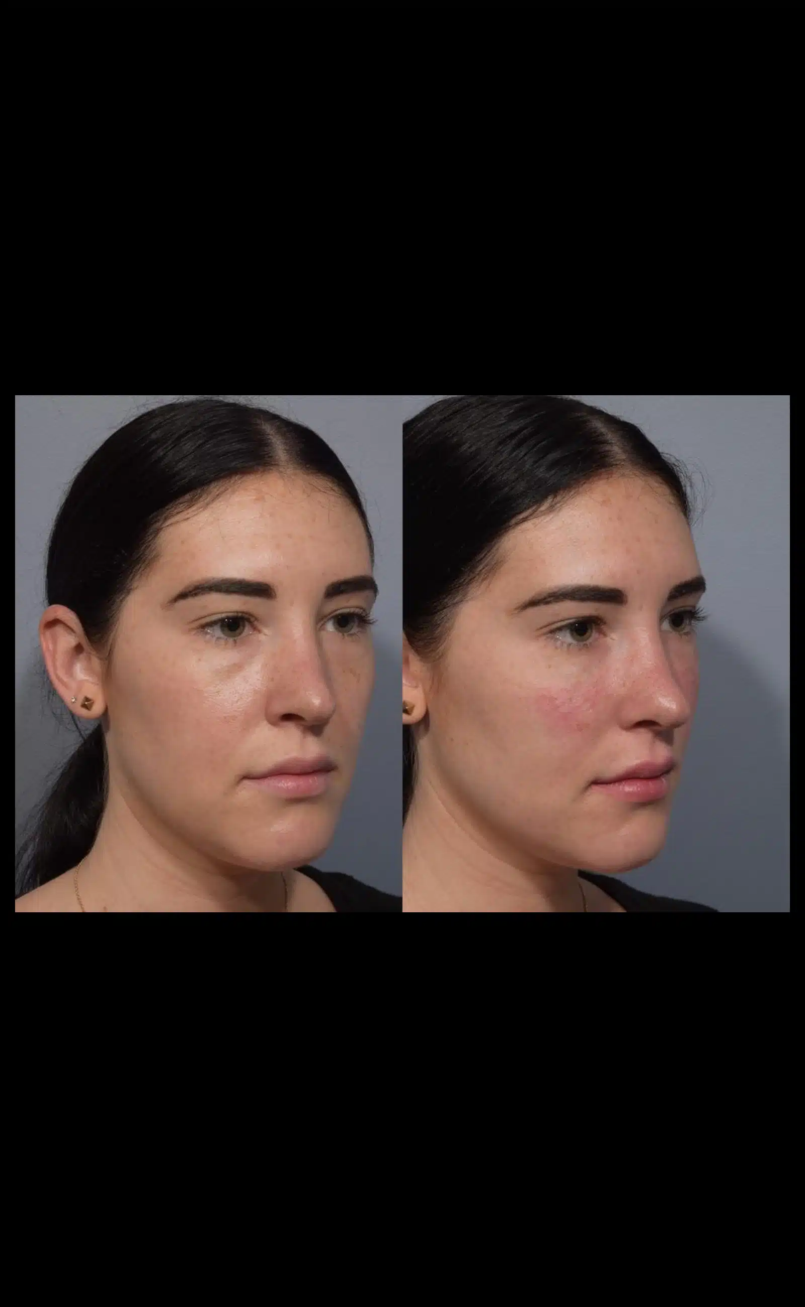 Natural Rejuvenation