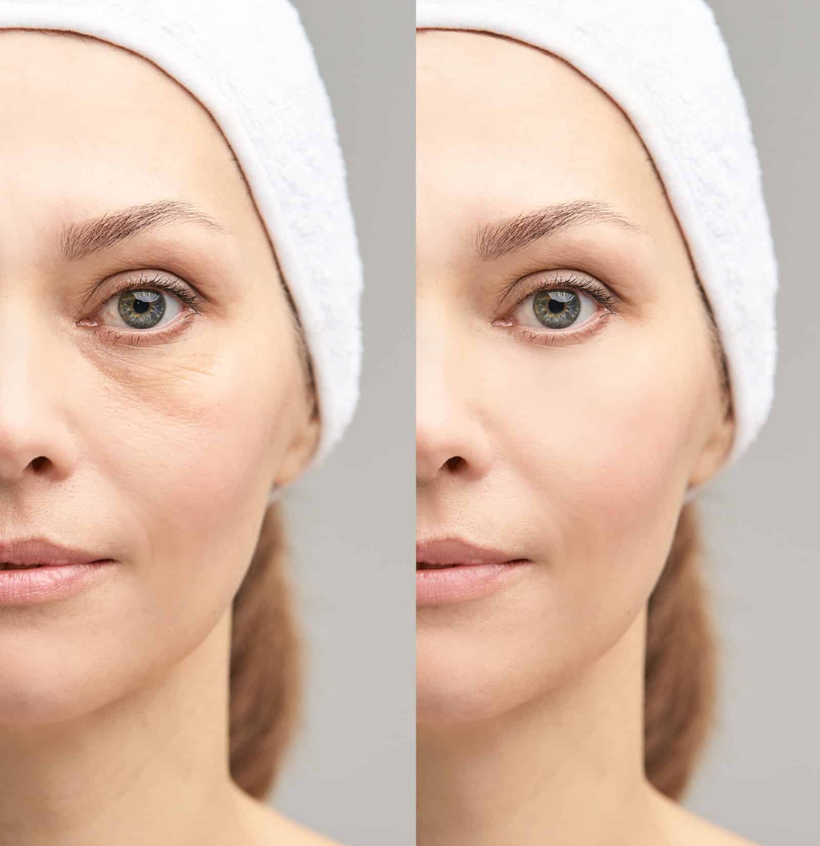 Non-Surgical and Minimally Invasive