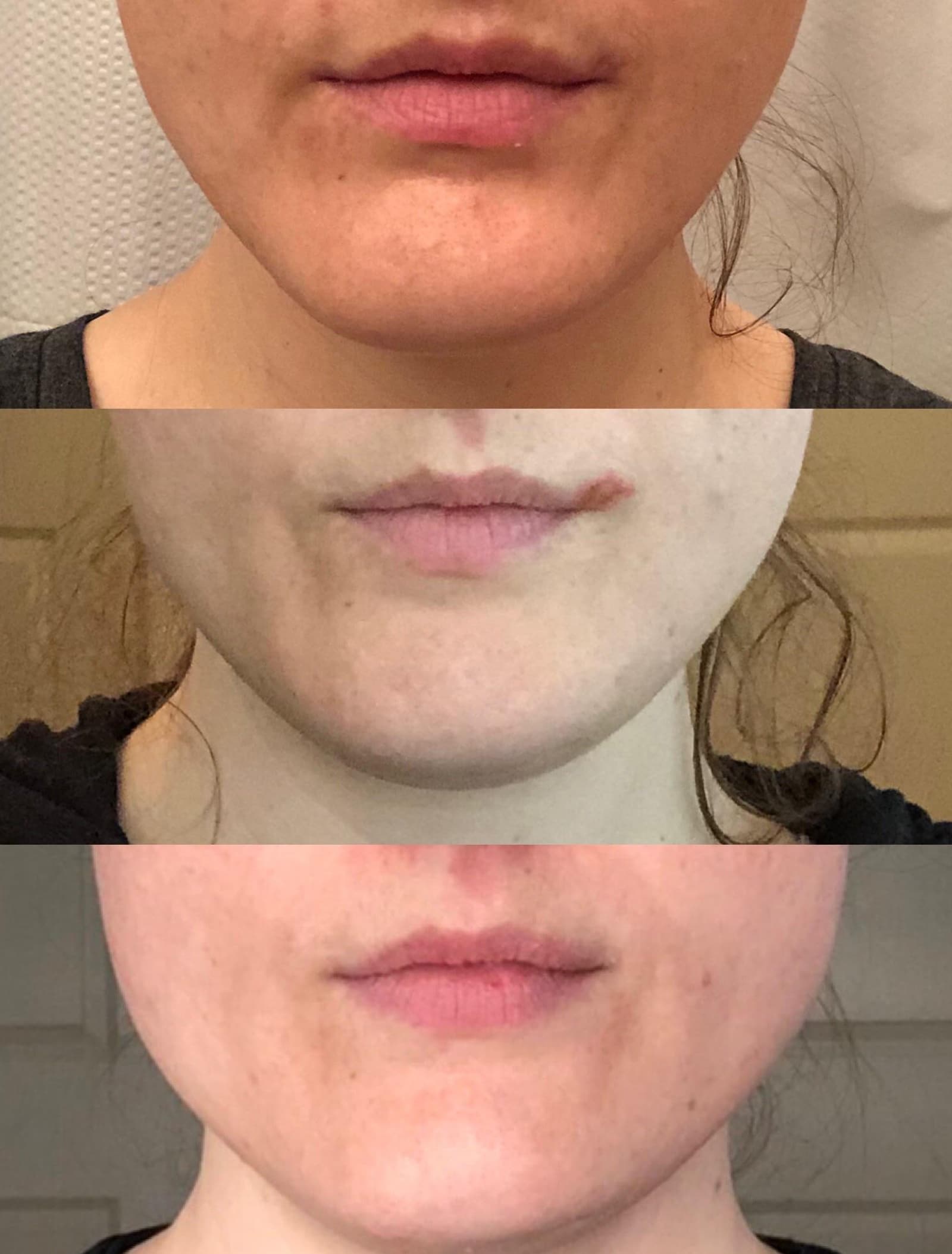 Personalized Treatment Plans