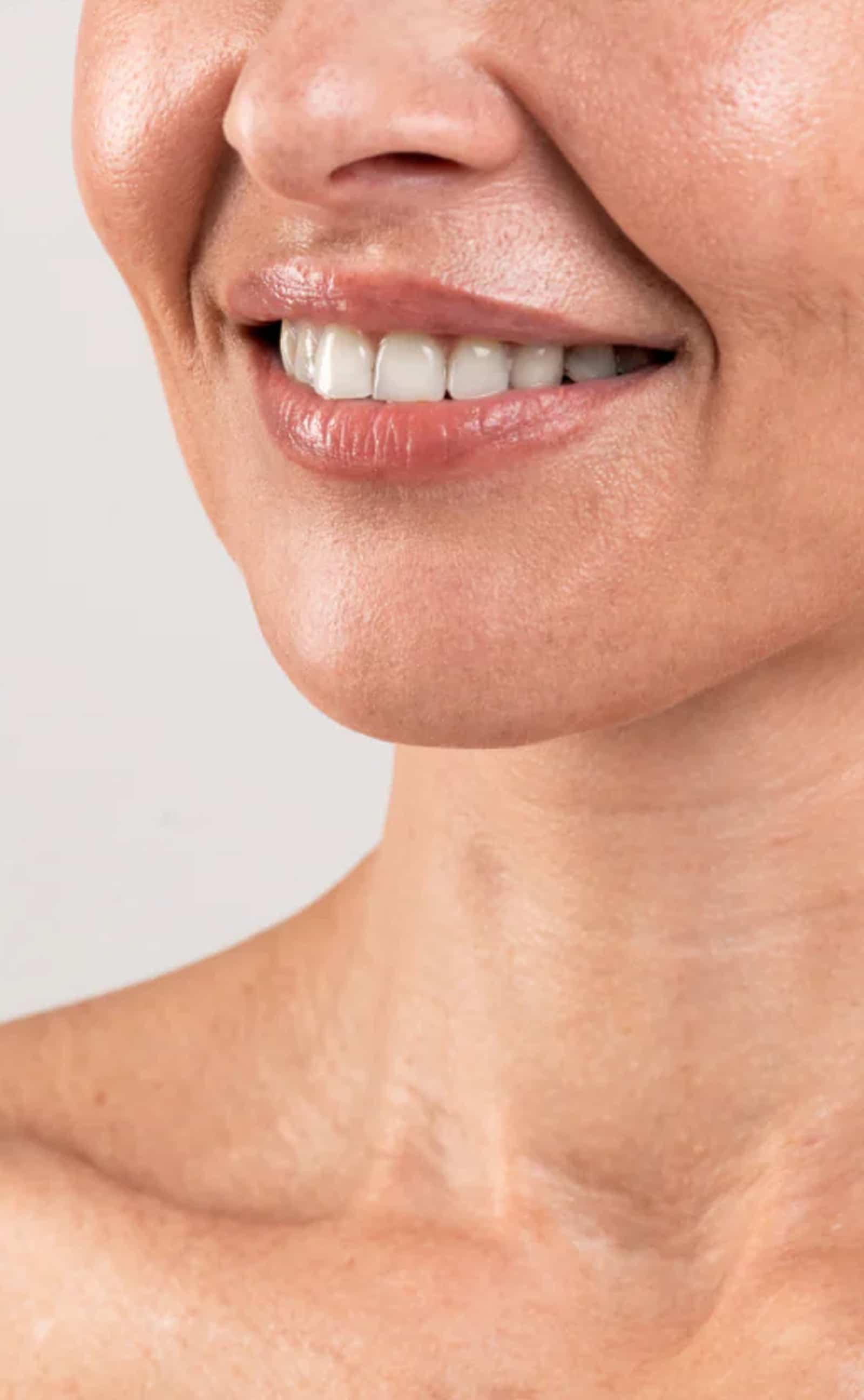 Post-Treatment Care and Lifestyle Tips