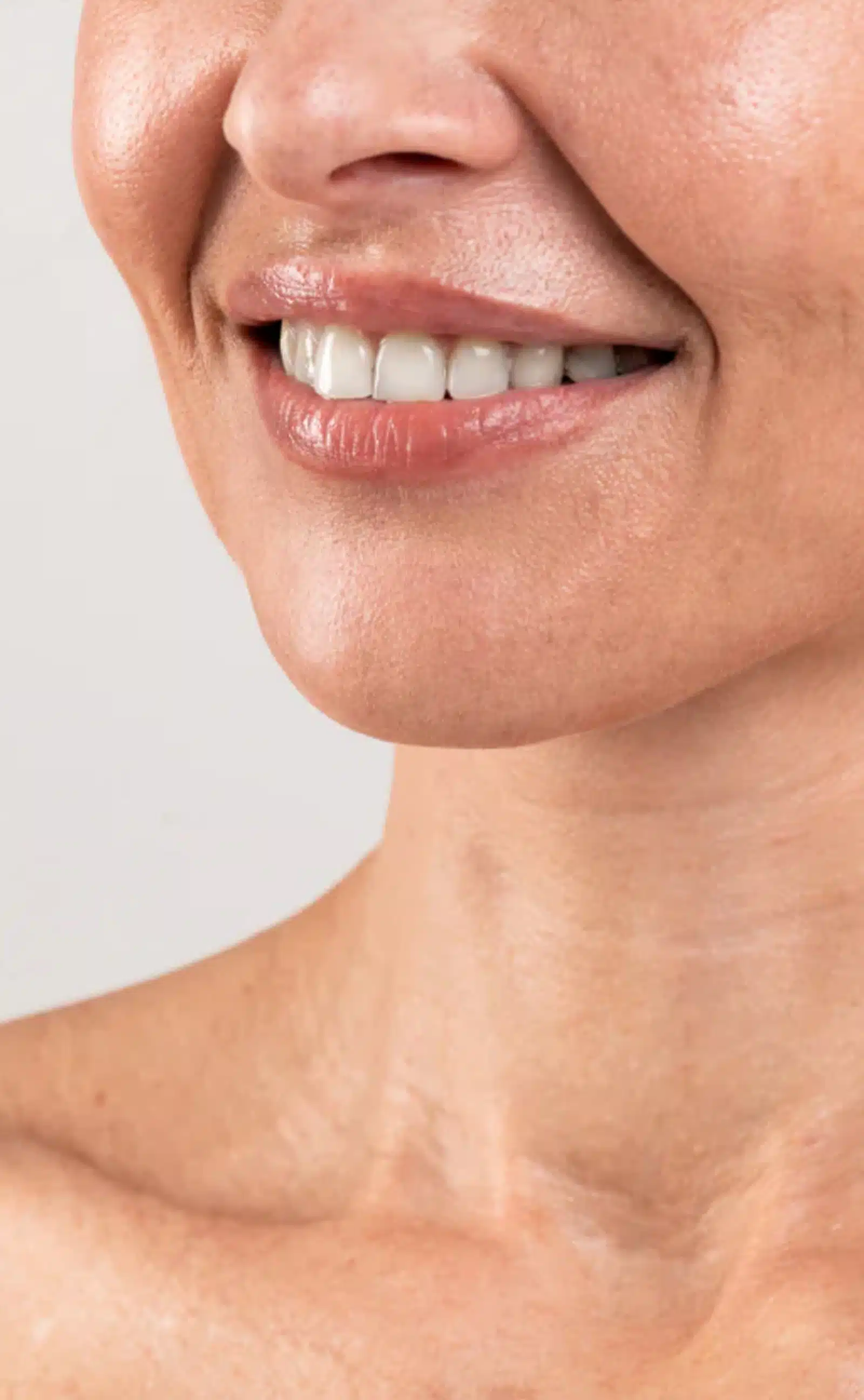 Post-Treatment Care and Lifestyle Tips Post-Treatment Care and Lifestyle Tips