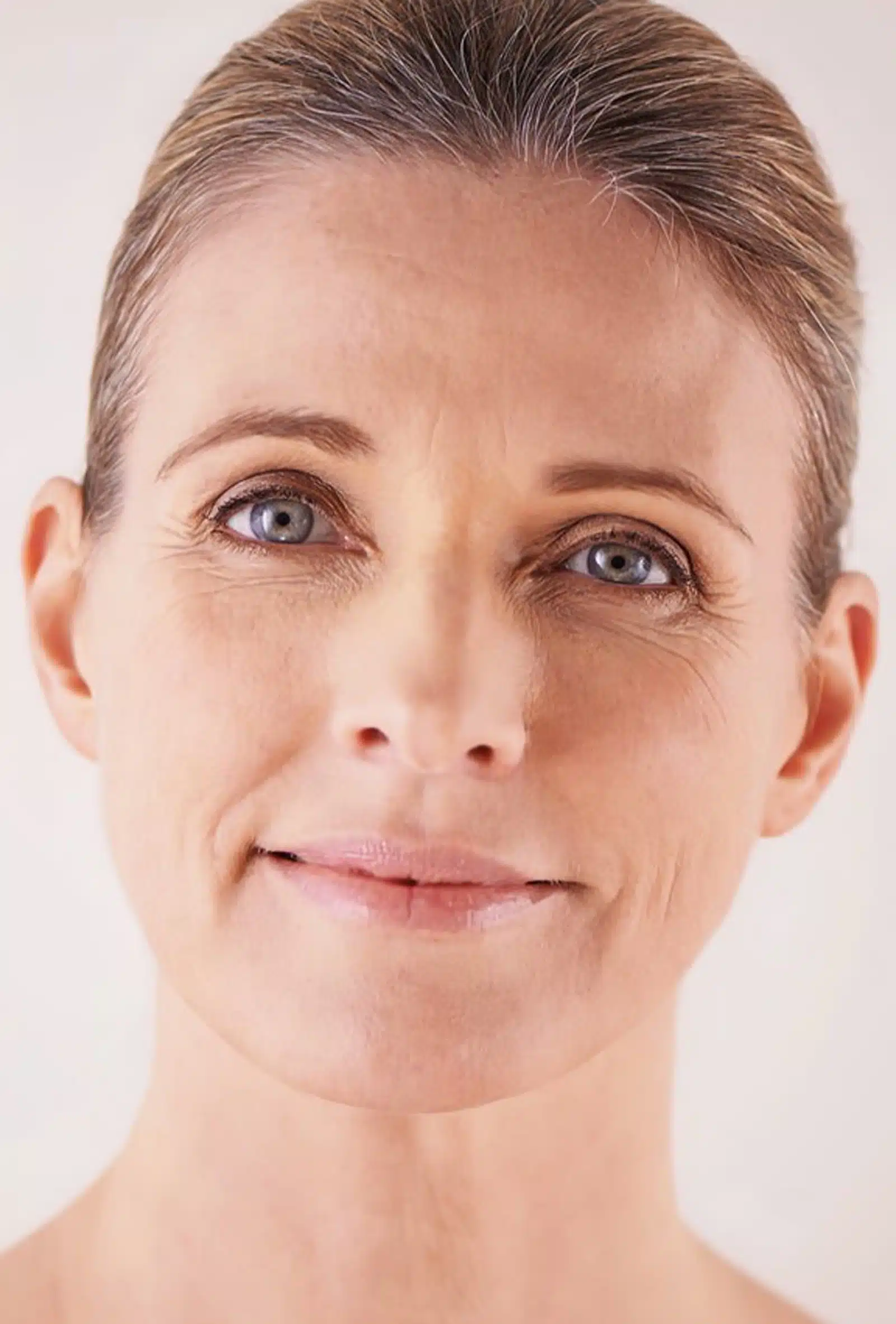 Post-Treatment Guidelines Post-Treatment Guidelines