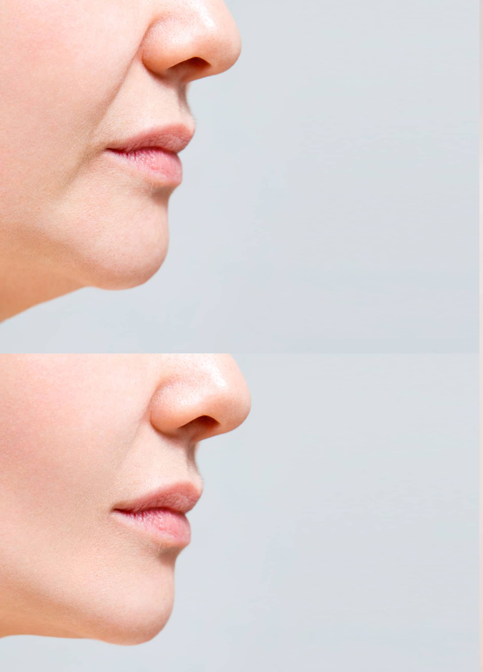 Precision Injection Treatment