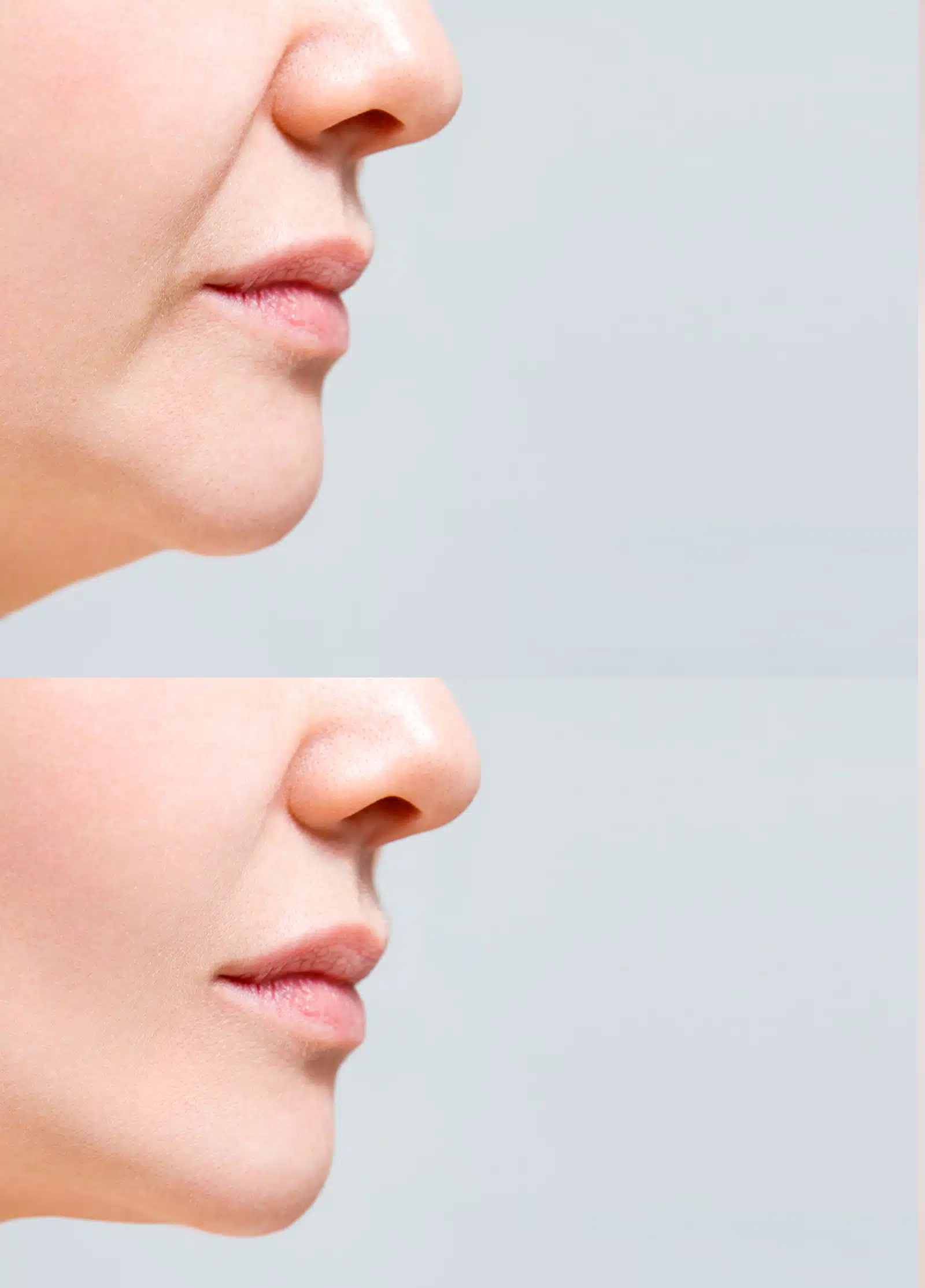 Precision Injection Treatment Precision Injection Treatment