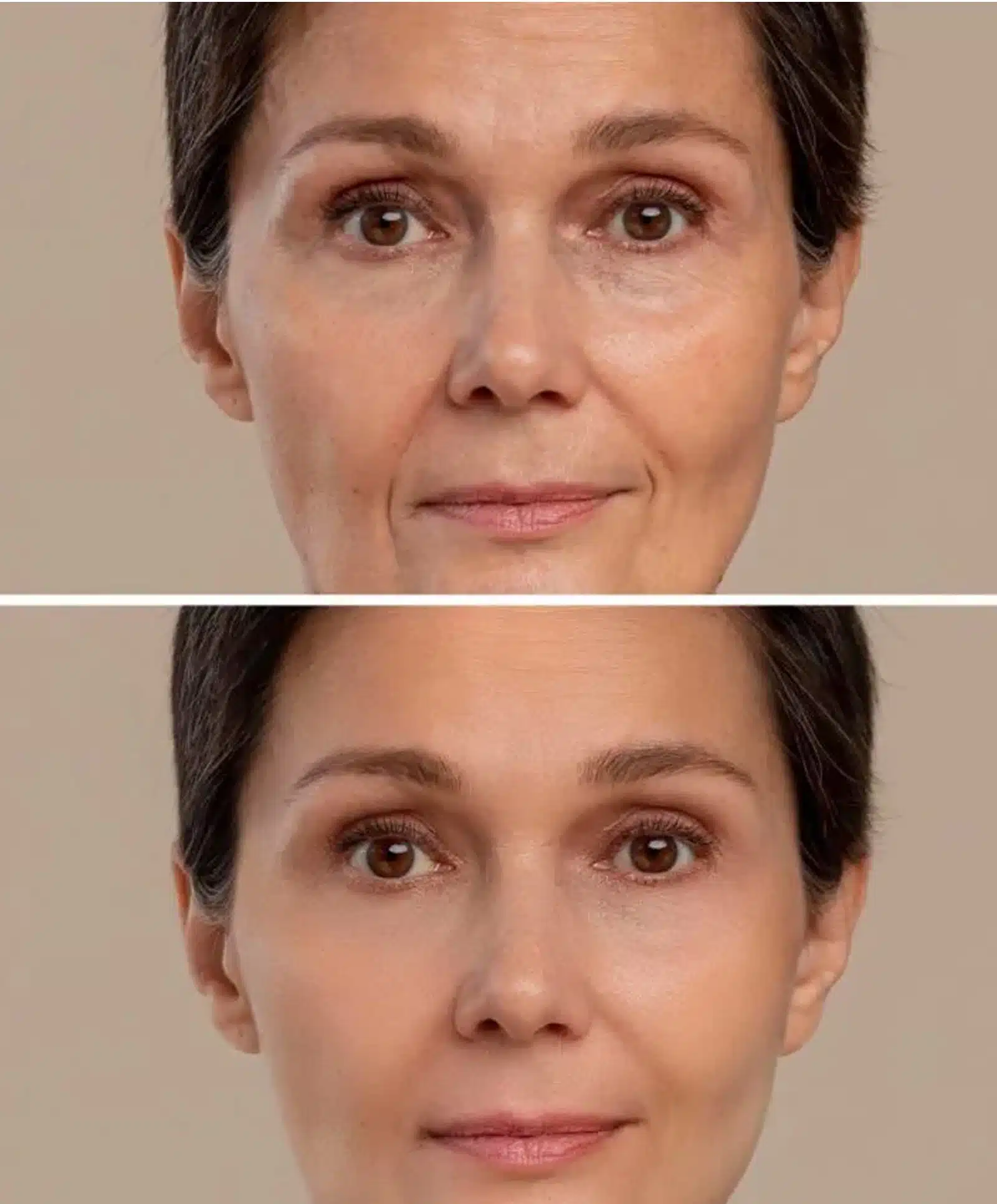 Results and Recovery Results and Recovery