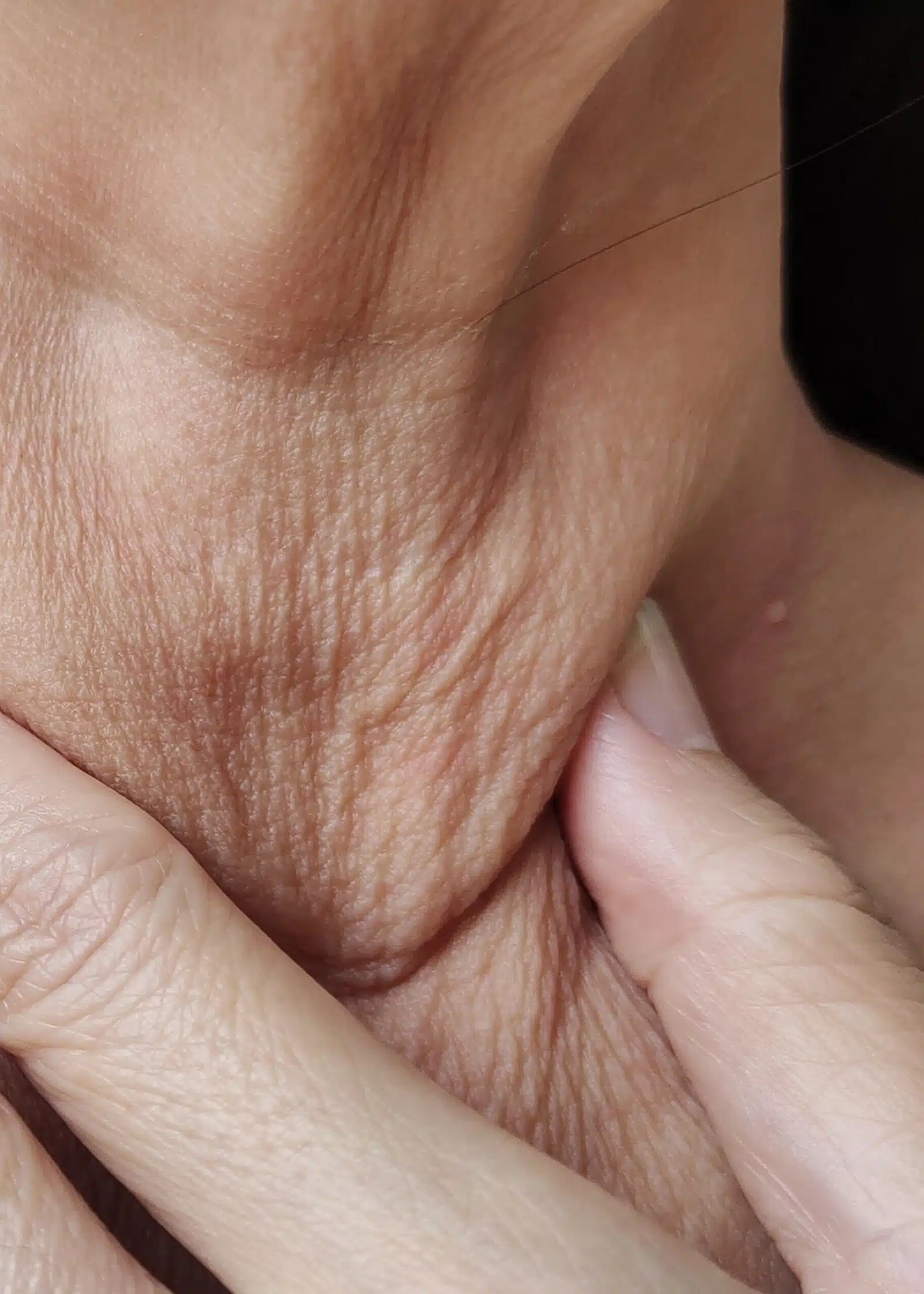 Safety Profile and Possible Side Effects Safety Profile and Possible Side Effects