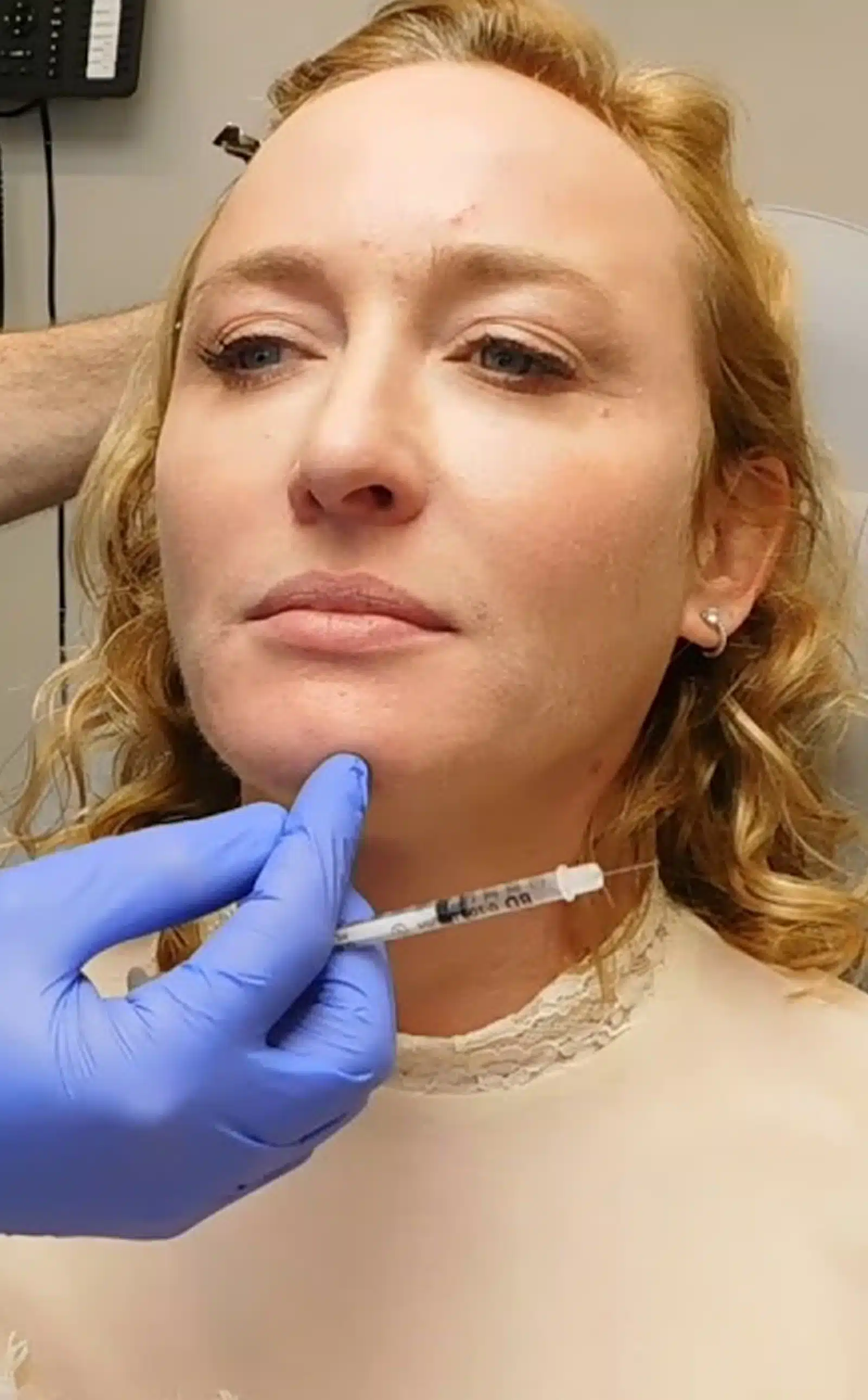 Science Behind Dysport