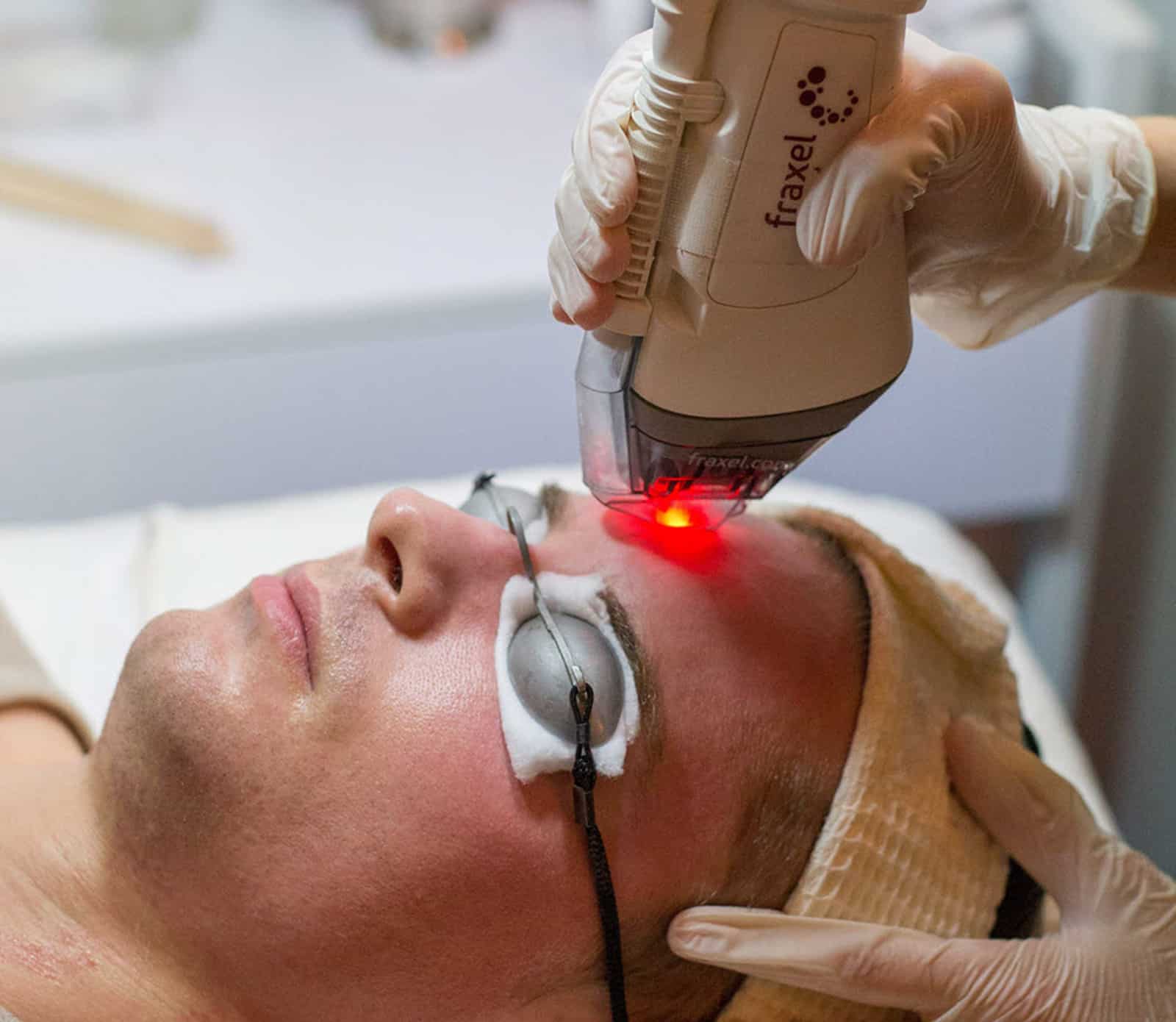Skin Issues Fraxel Can Effectively Treat