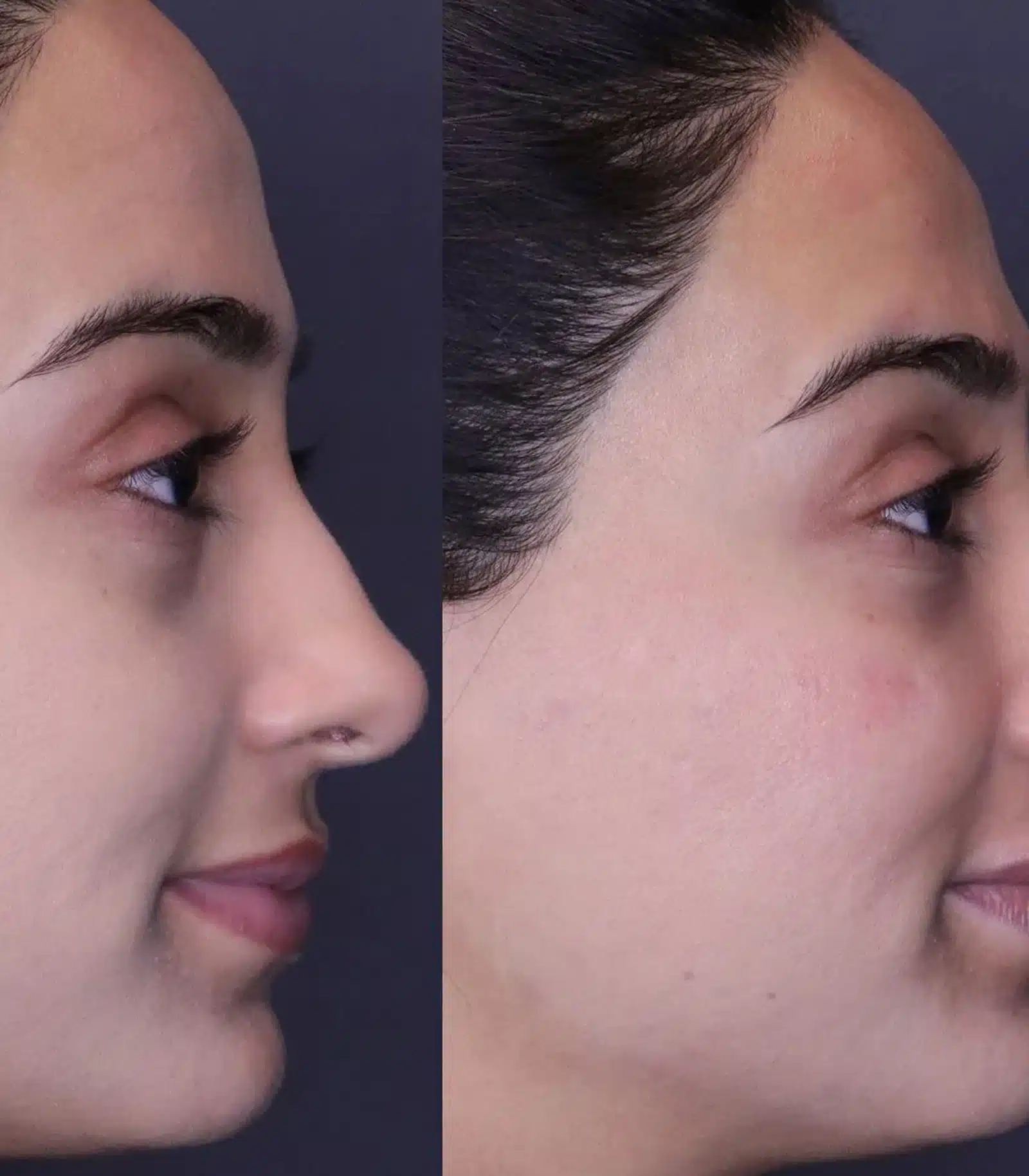 What They Are and Why They Occur