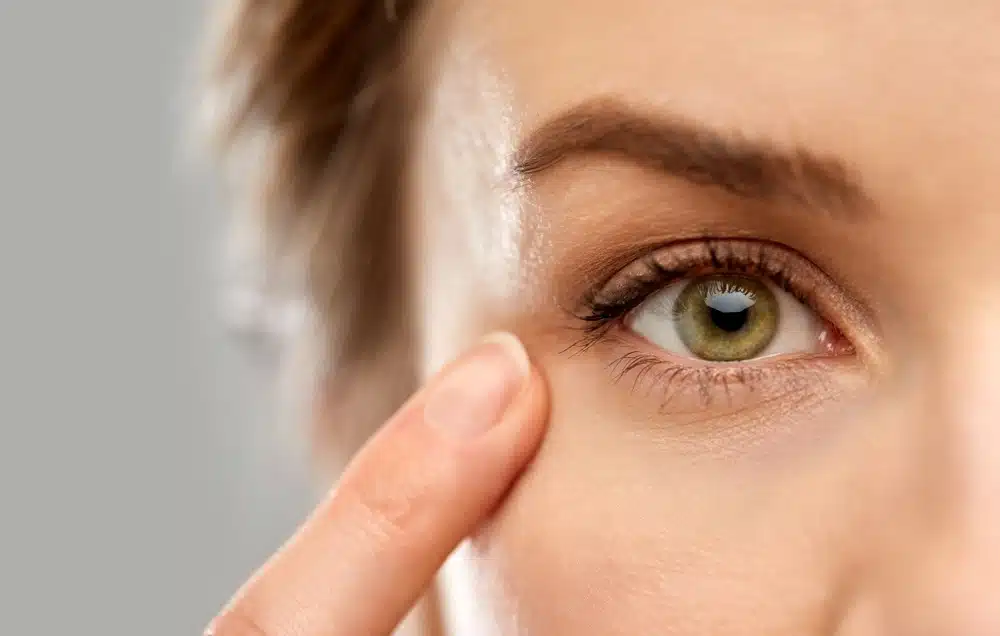 Best Eye Wrinkle Treatment in Orlando