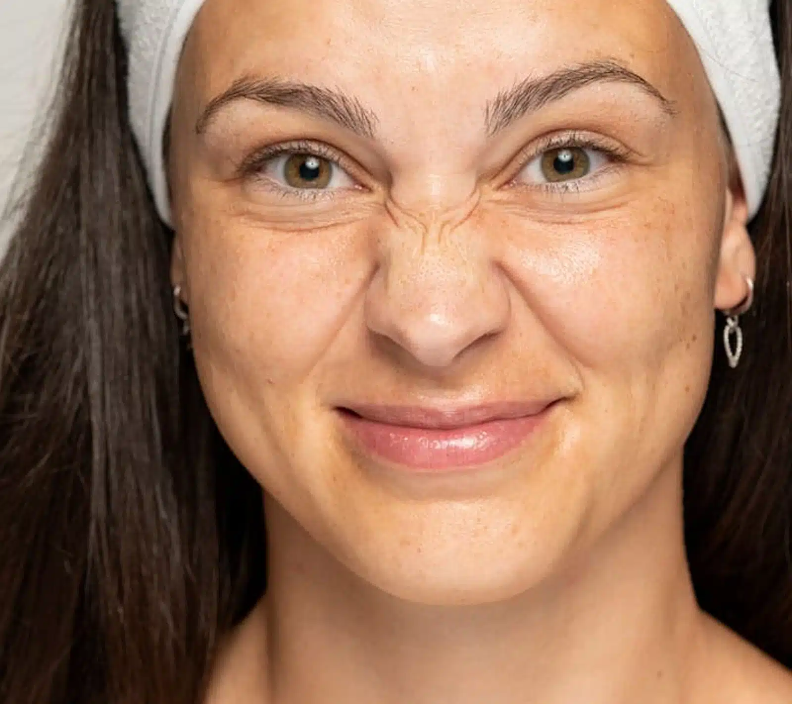Enhancing Facial Youthfulness Orlando Laser Hair Removal