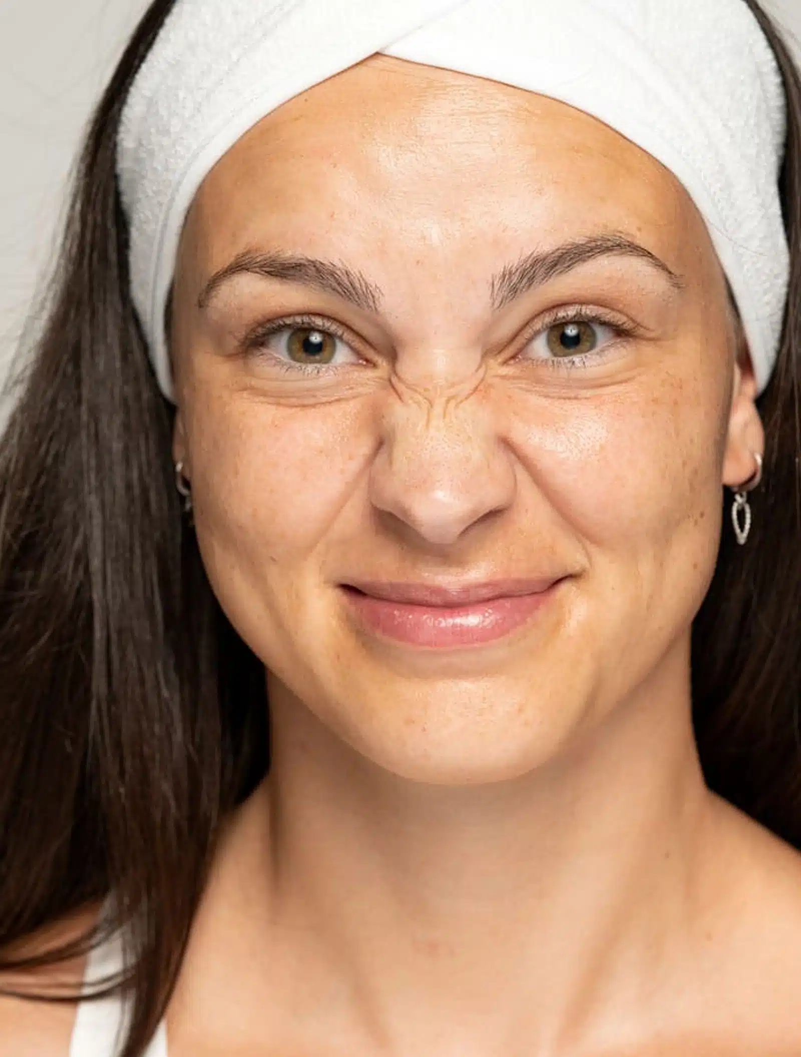 Enhancing Facial Youthfulness