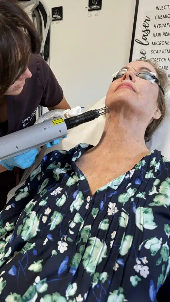 micro needling treatment winter park florida