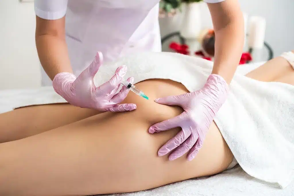 cellulite treatment winter park