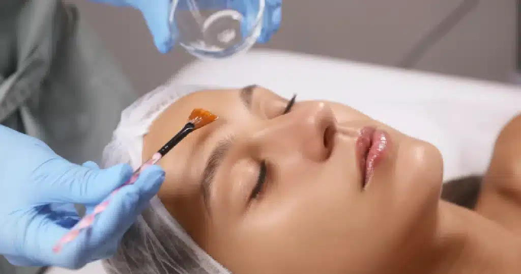 cool peel skin resurfacing orlando