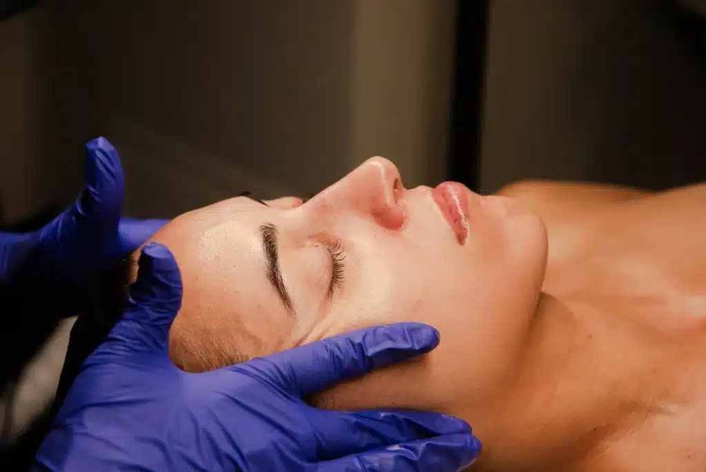 cool peel skin resurfacing orlando
