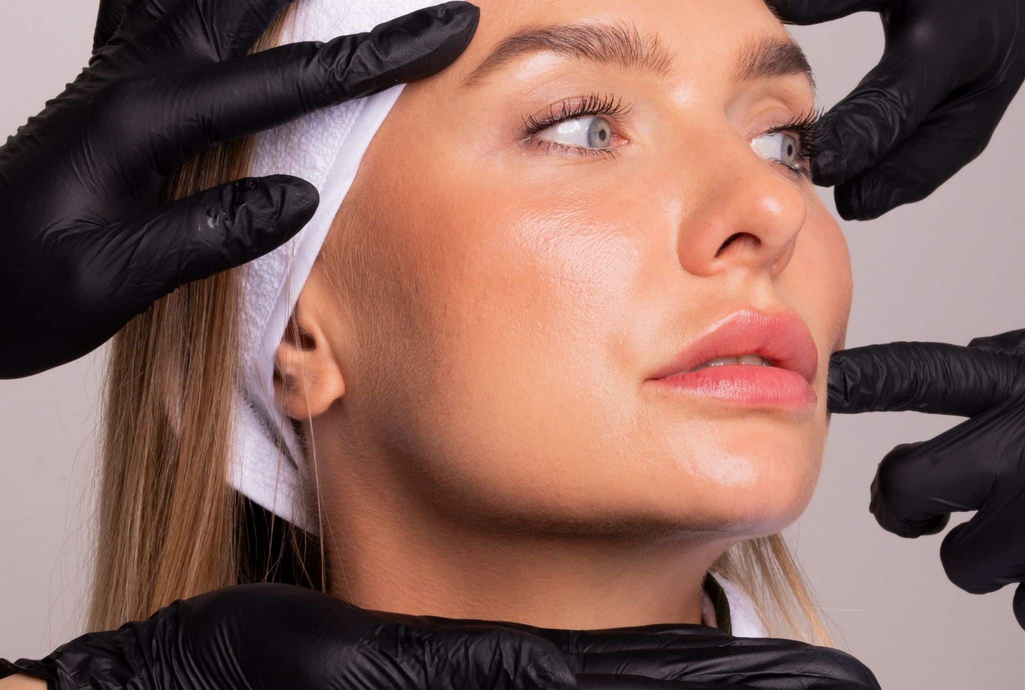 smile line treatment orlando