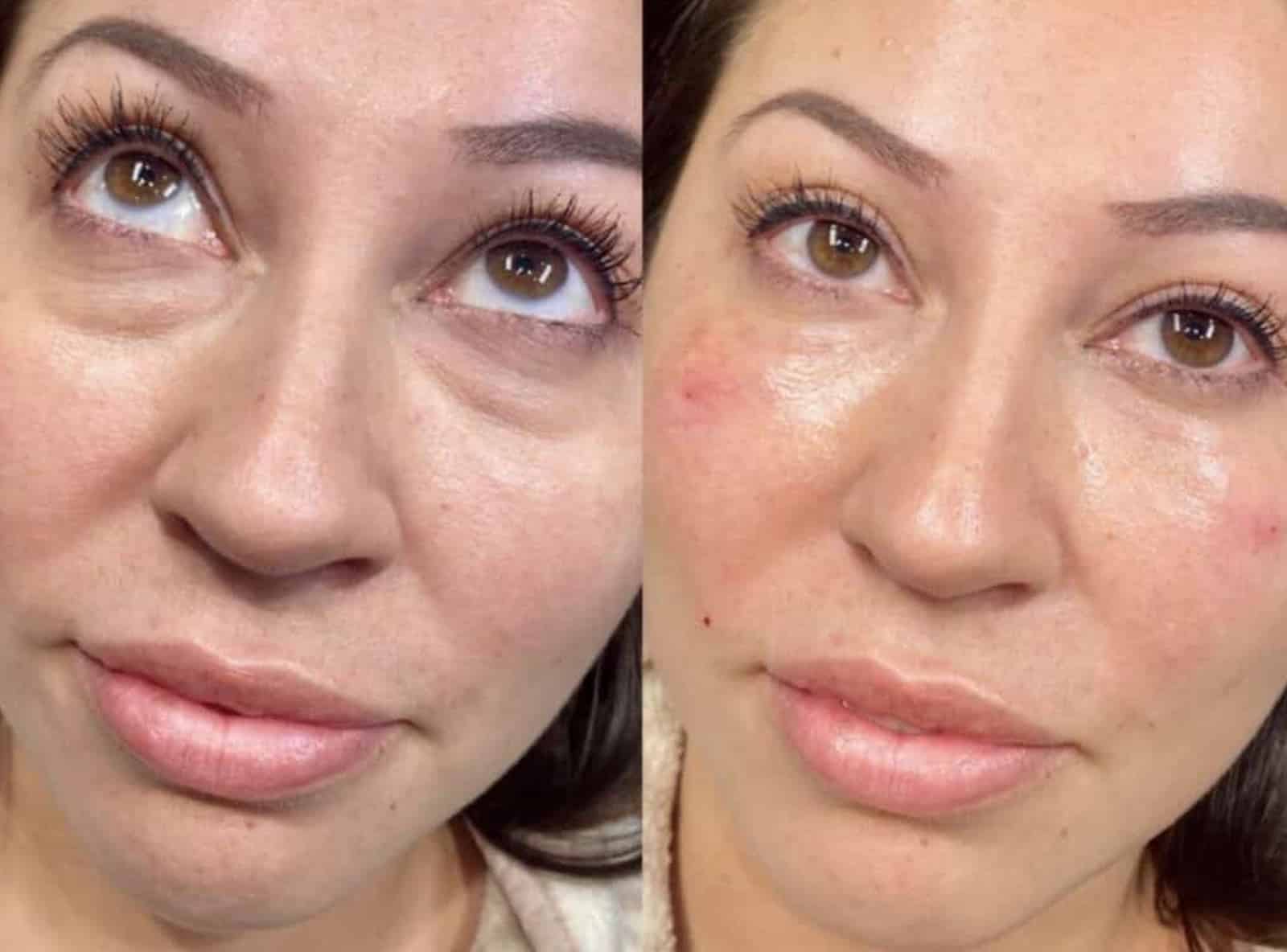 Advantages of Choosing IPL Advantages of Choosing IPL