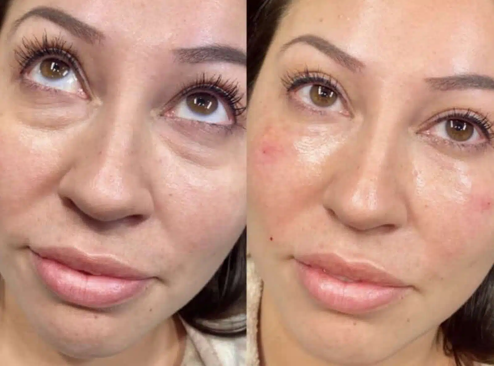 Advantages of Choosing IPL Advantages of Choosing IPL