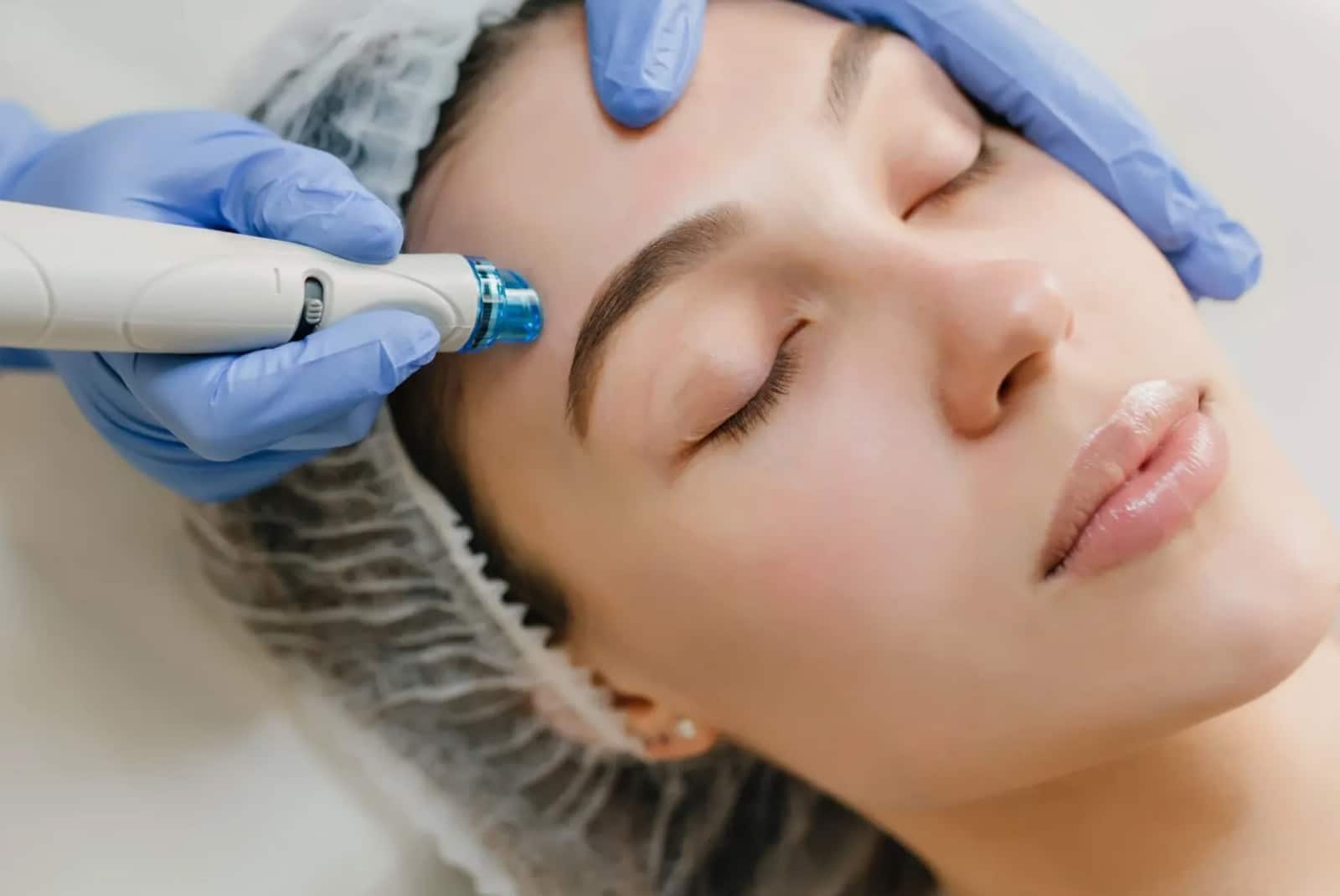 Faster results treatment Fine lines & wrinkles