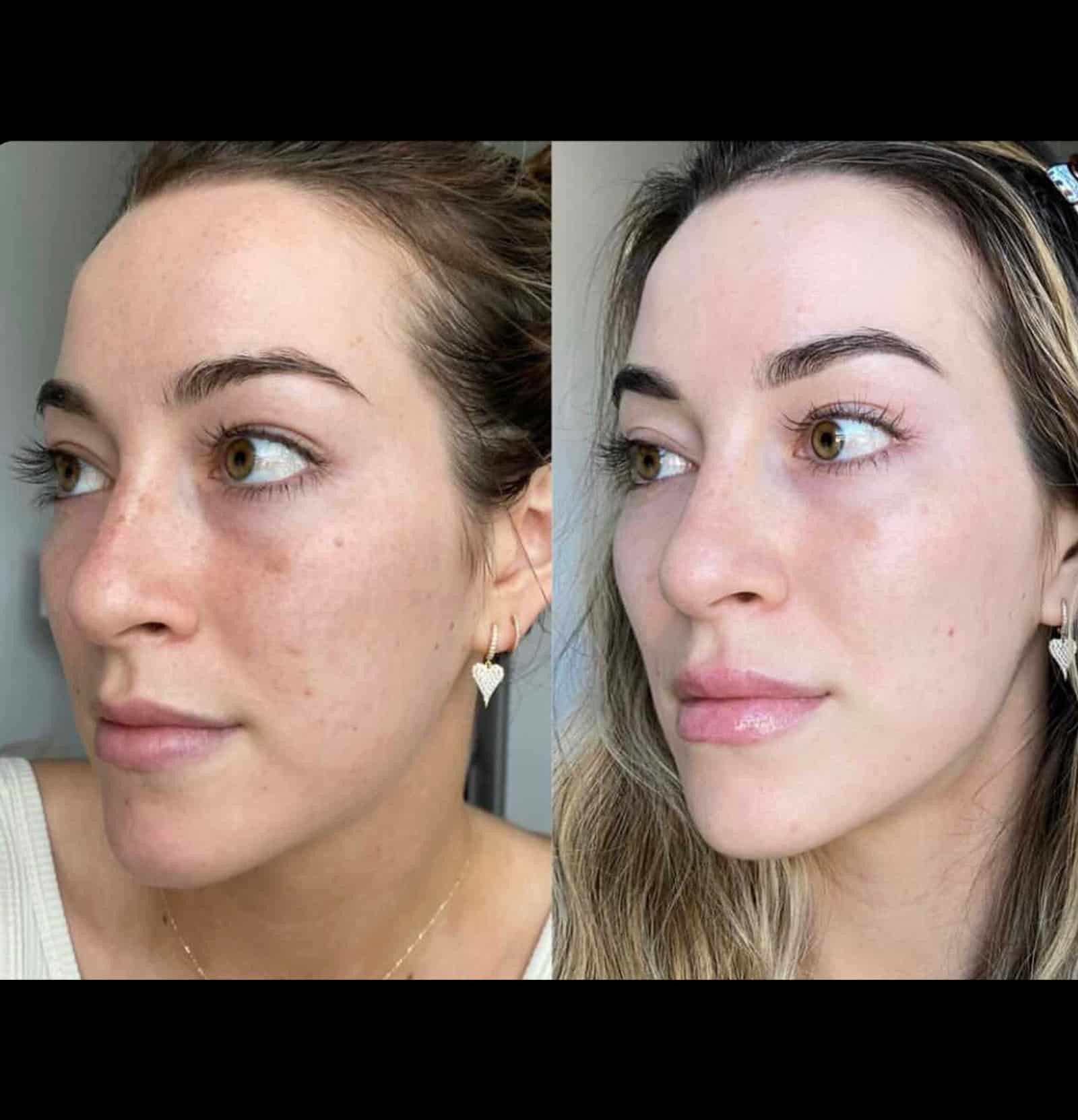 Journey to Radiant Skin Journey to Radiant Skin