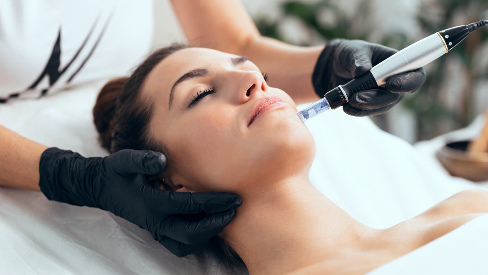 Microneedling Controlled Renewal