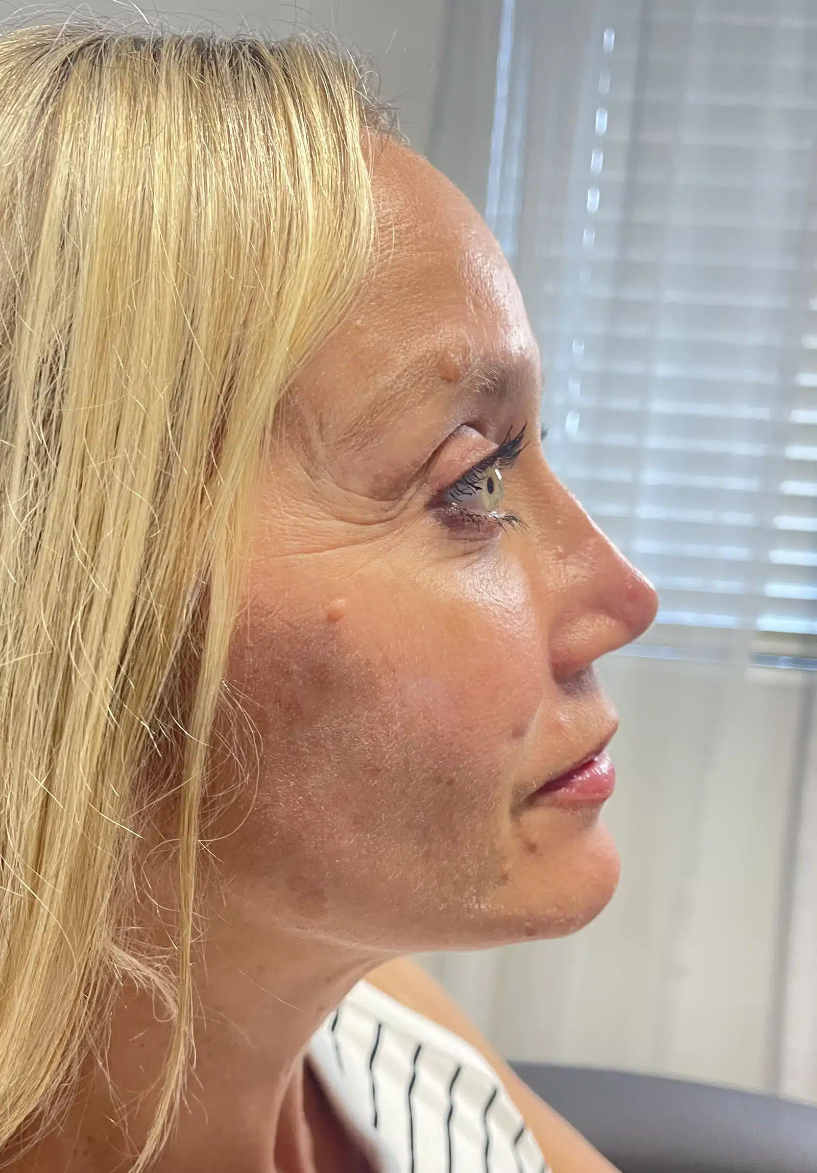 Transforms Your Skin Transforms Your Skin