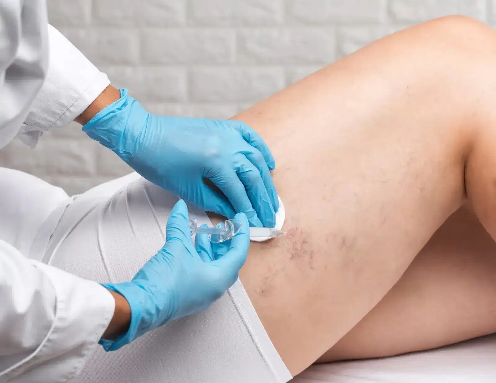Expert Vein Treatment Near You for Clearer Expert Vein Treatment Near You for Clearer