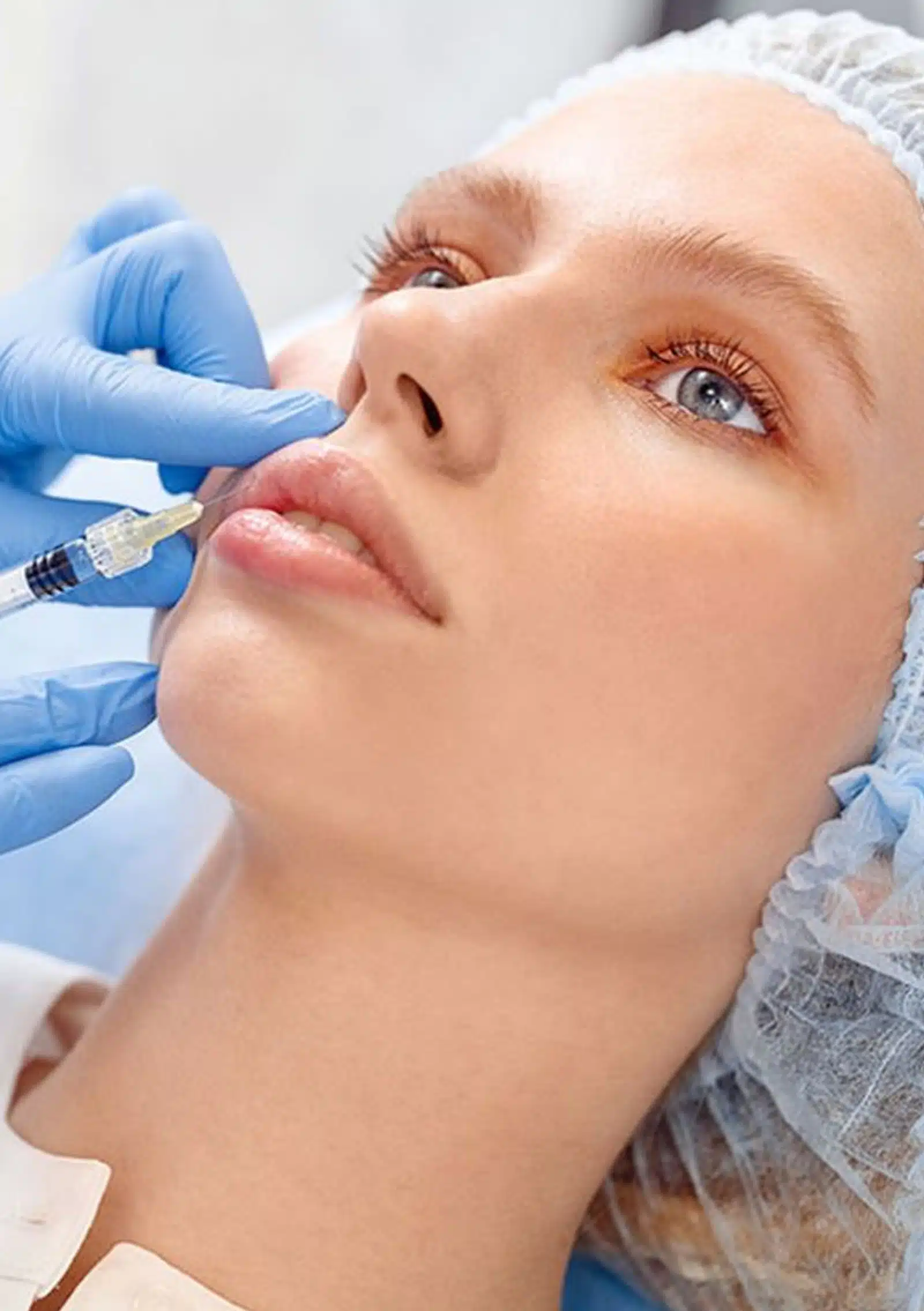 Fillers with Other Aesthetic Treatments Botox or Dysport