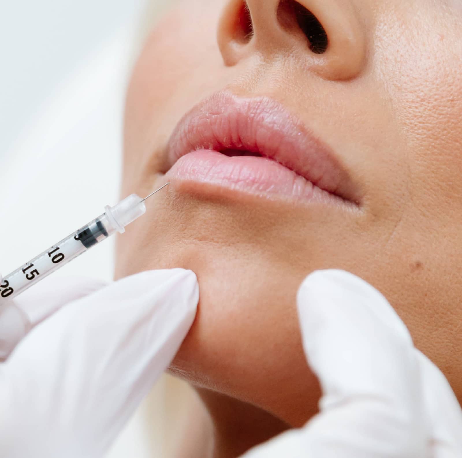 Jawline enhancement Jawline enhancement