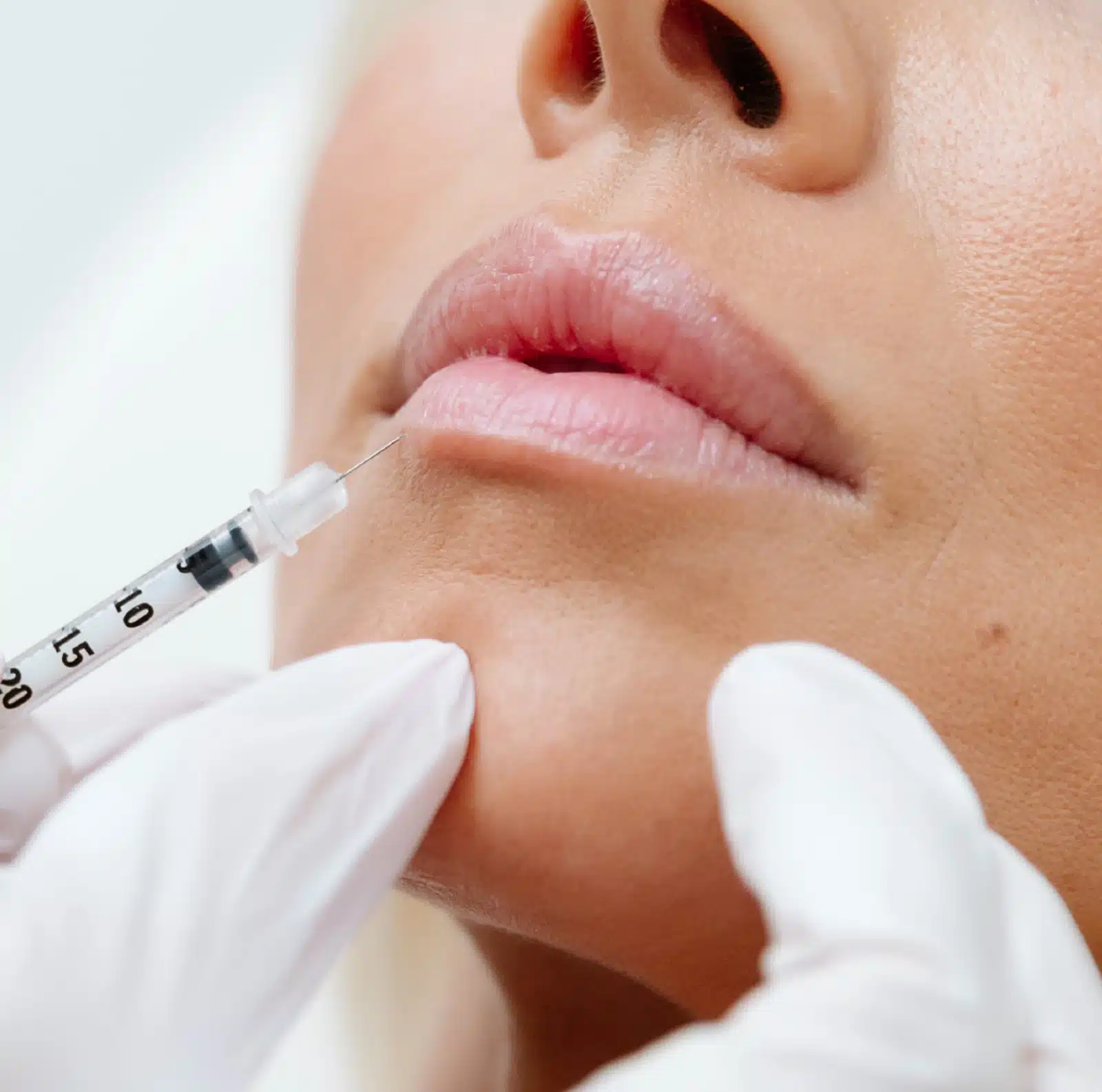 Jawline enhancement Jawline enhancement