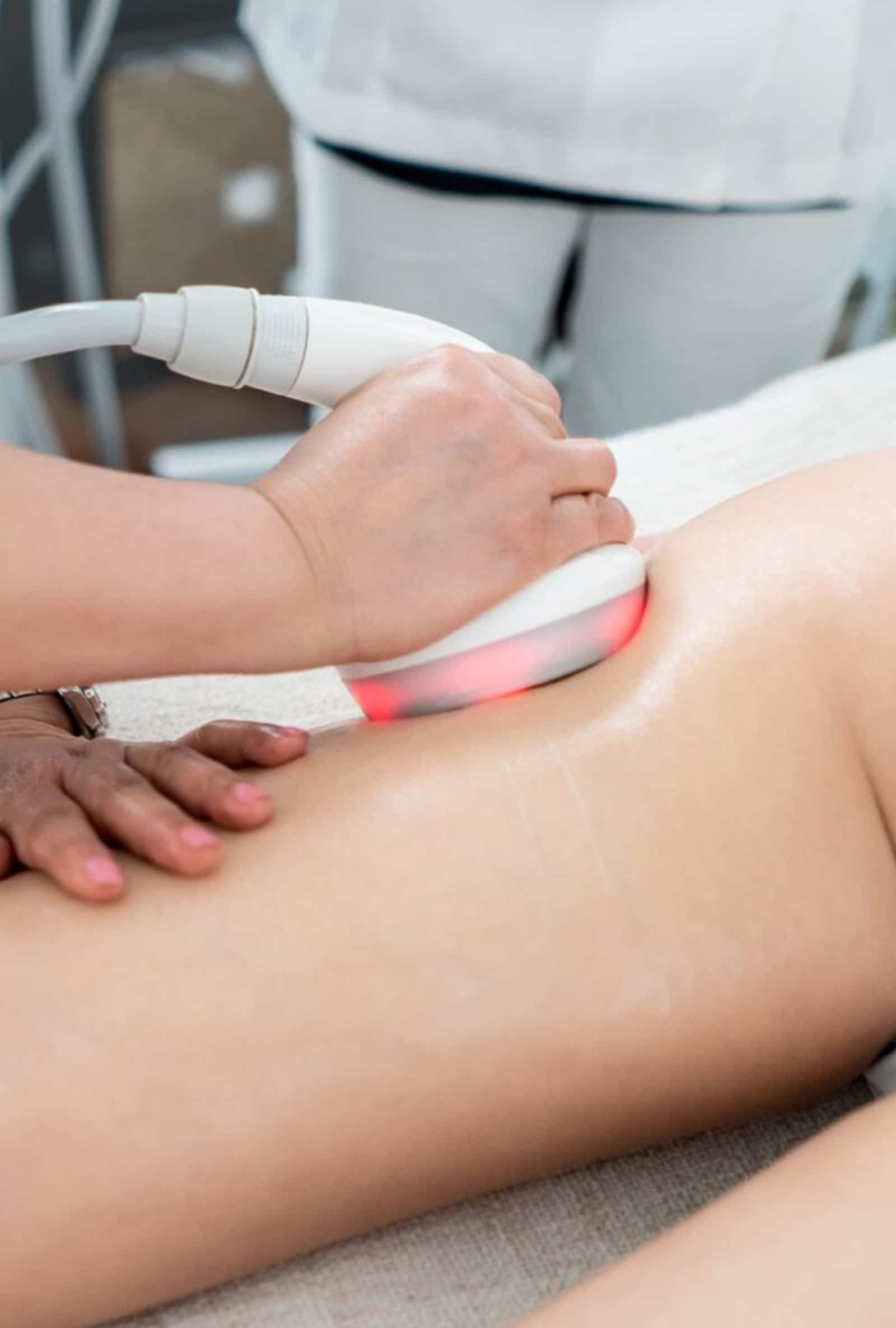 Laser-Assisted Cellulite Reduction