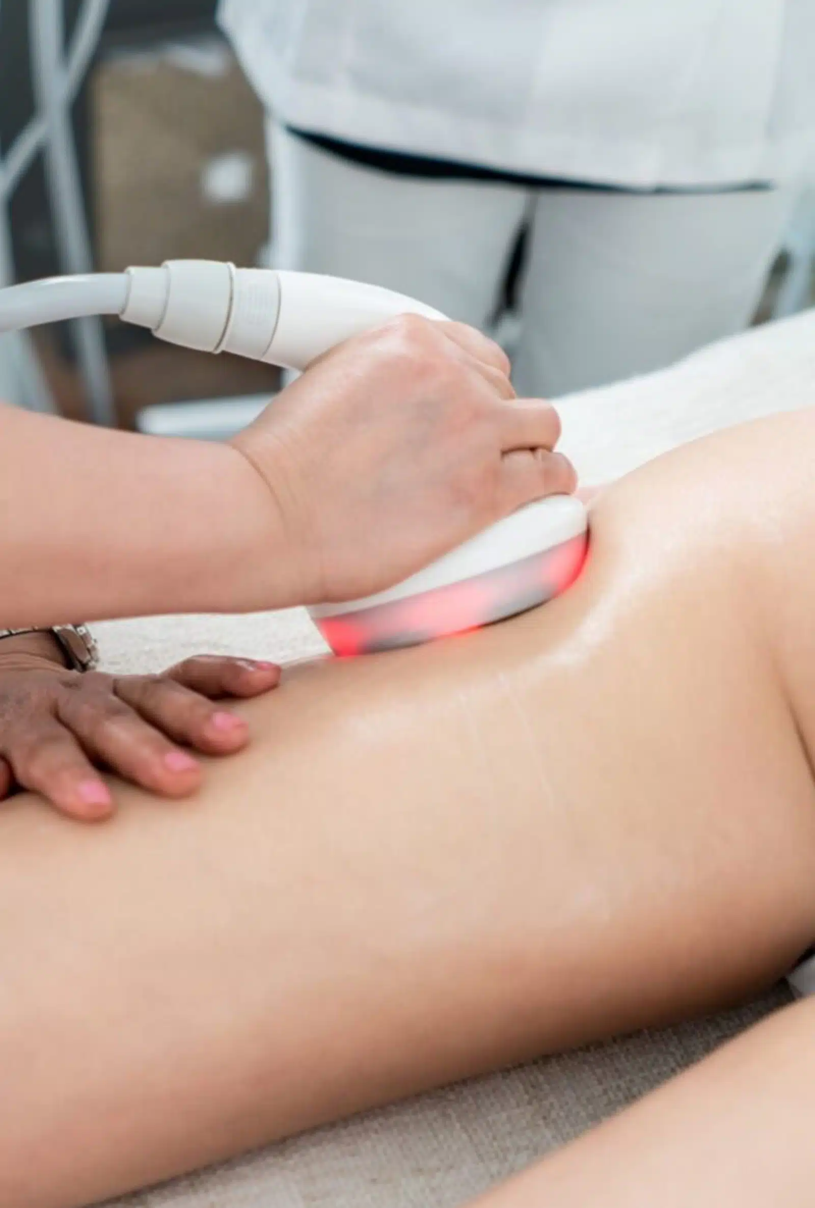Laser-Assisted Cellulite Reduction
