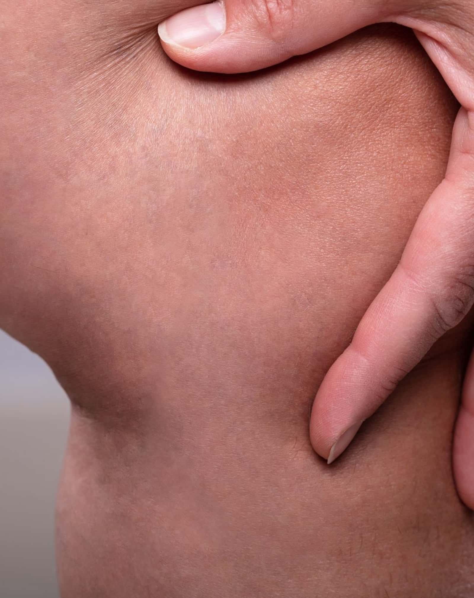 Professional Vein Treatment anti-aging medicine