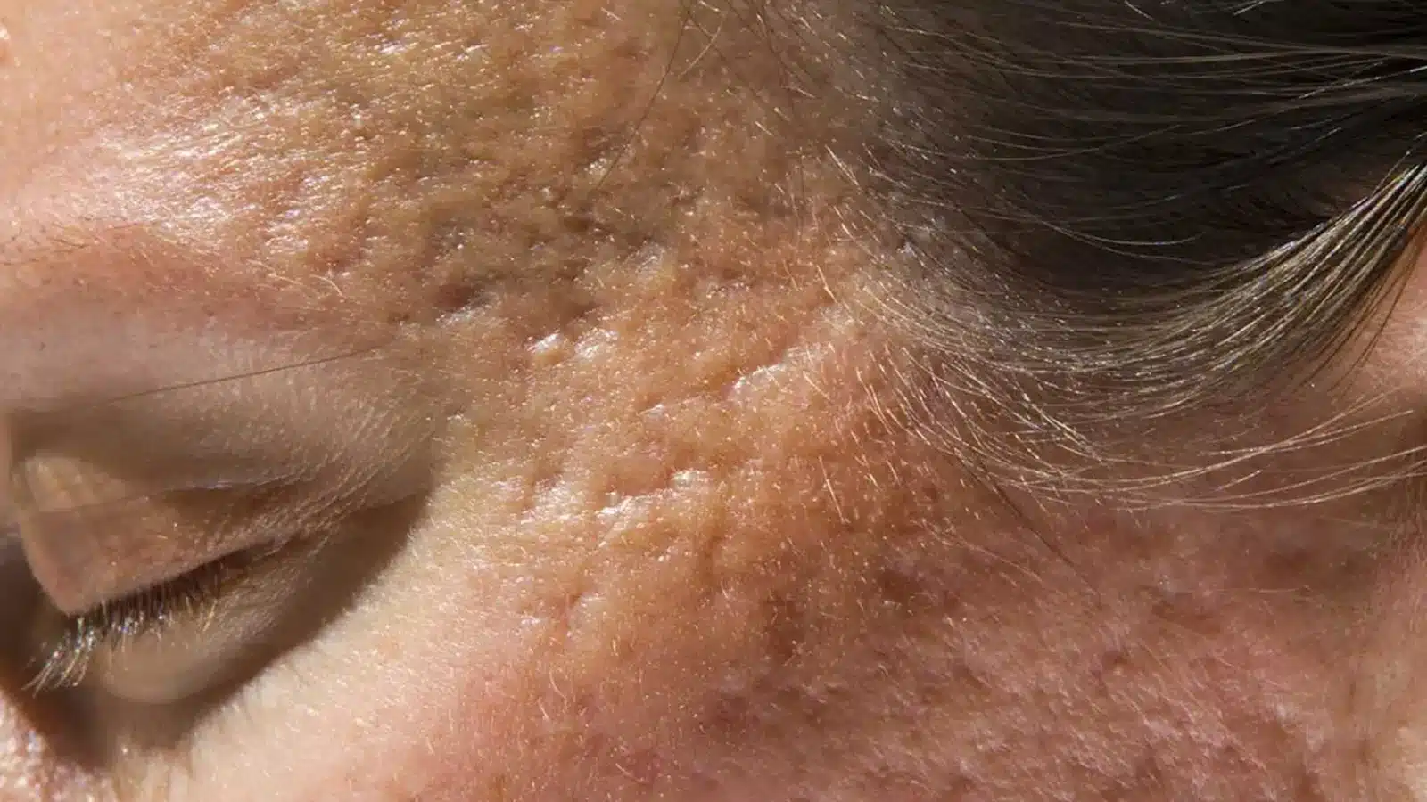 CoolMax Pro Peel