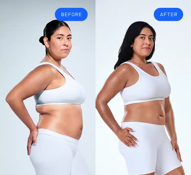 How Does CoolSculpting Work?