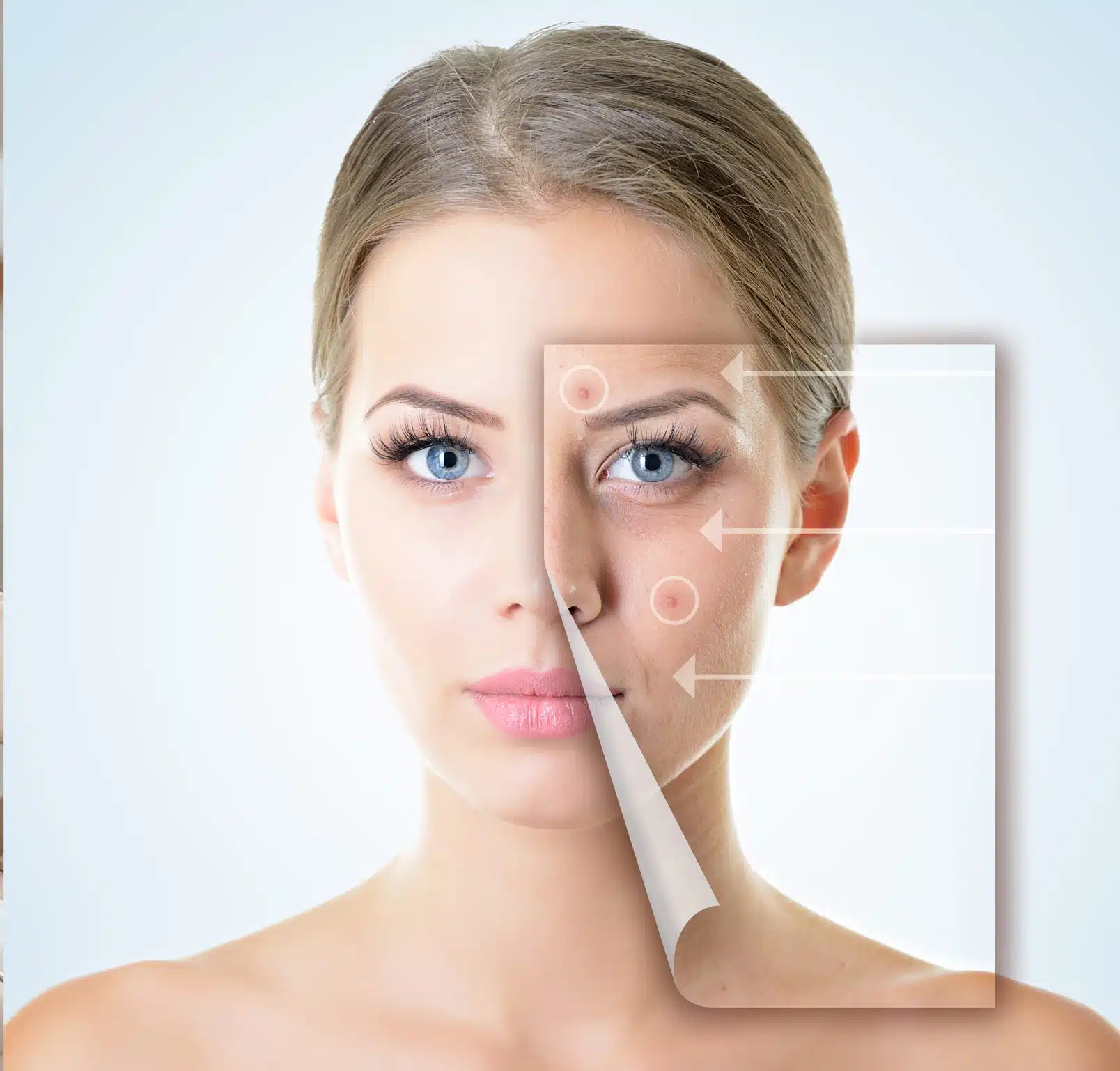 Non-Surgical Facial Rejuvenation Comfortable Treatment