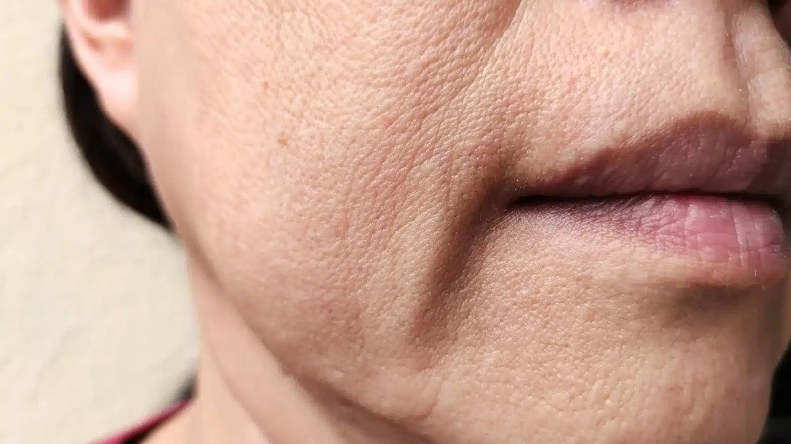 CoolMax Pro Peel