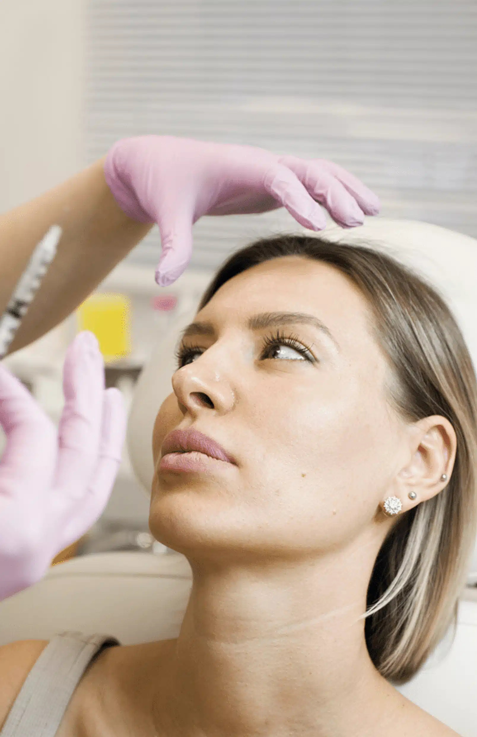 Tired Eyes With Under-Eye Filler Treatments Hand Rejuvenation