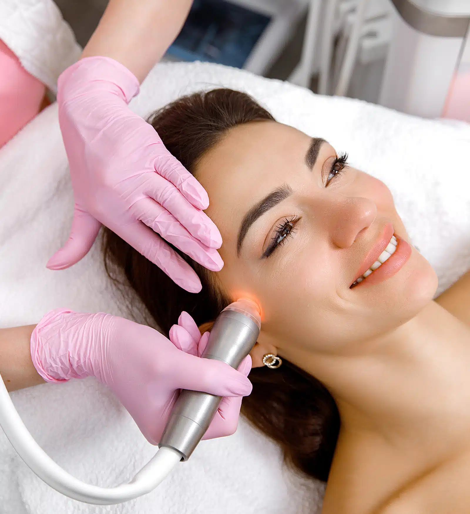 Acne Scar Treatment