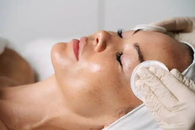coolmax pro peel treatment