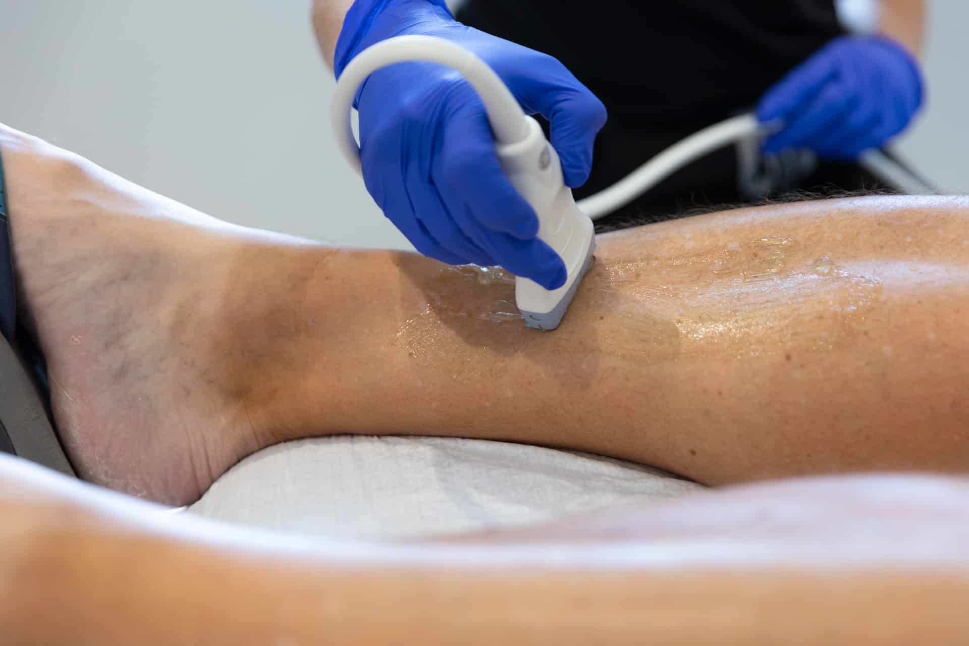 Leg Vein Treatment Winter Park: Restore Comfort, Confidence, and Circulatory Health