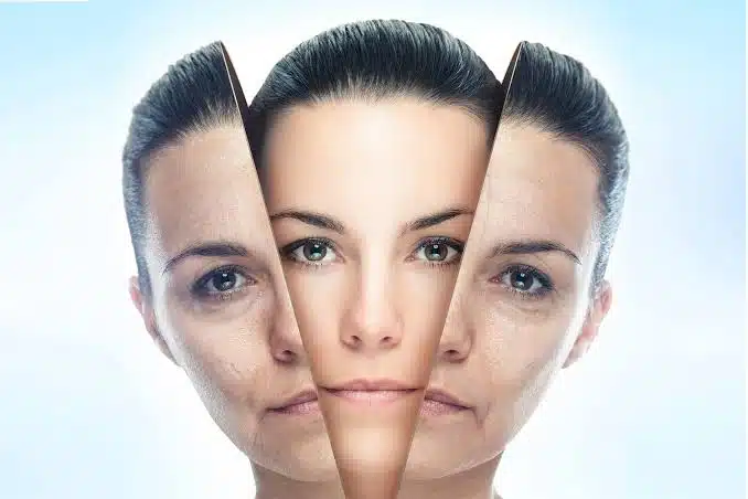 peel mode vs deep resurfacing