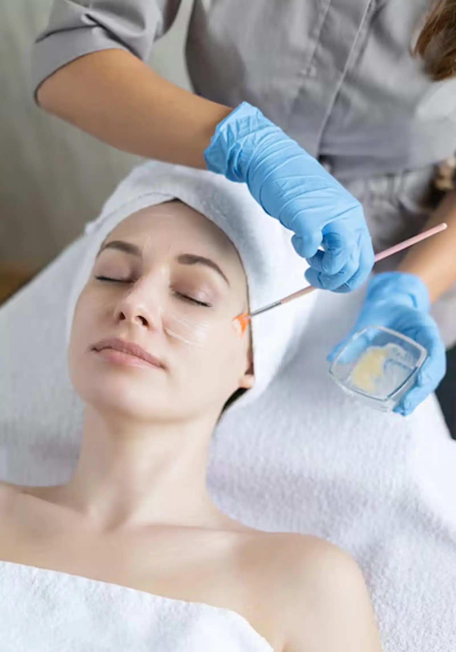 Aesthetic Medicine Rules Winter Park Causes Acne Scars