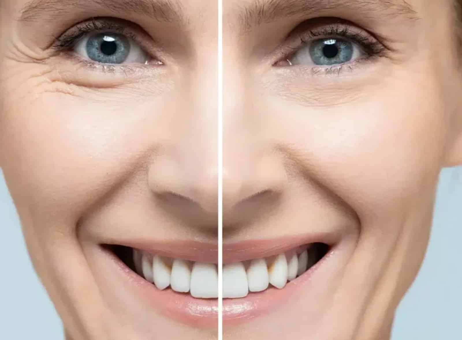 Lip border definition